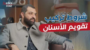 شروط تركيب تقويم الاسنان 